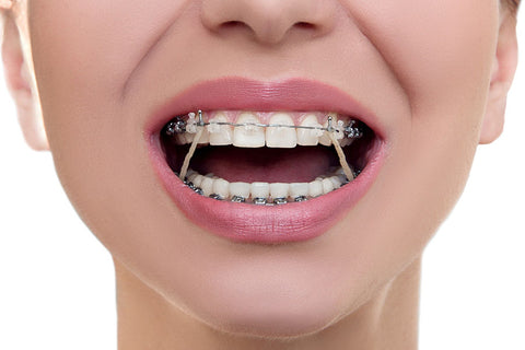 Poster Odontologia - Odontology - Profissões